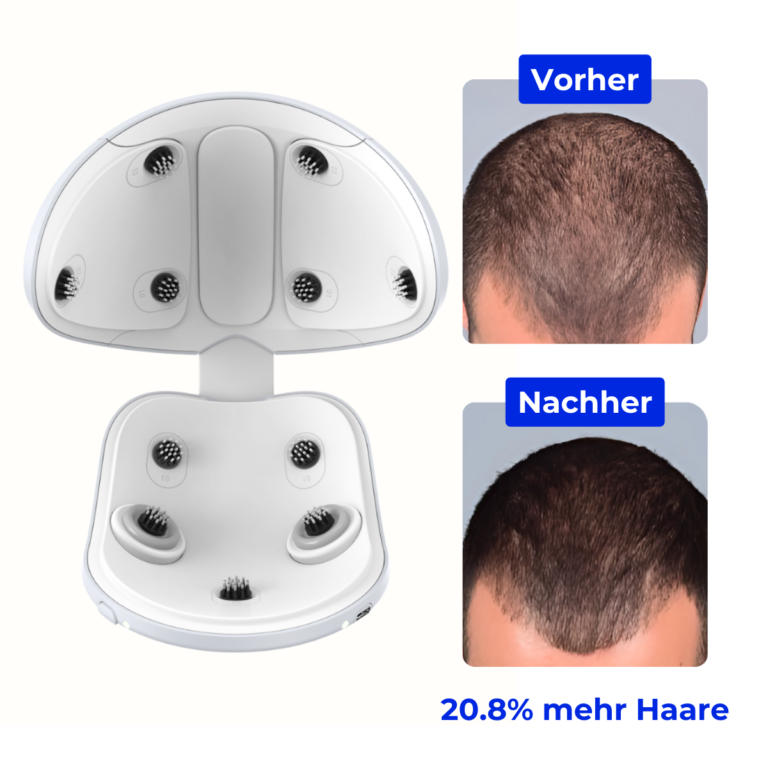 Before and After